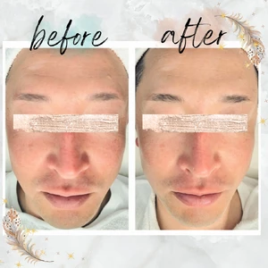 Before・After写真 (3)