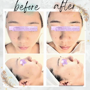 Before・After写真 (4)